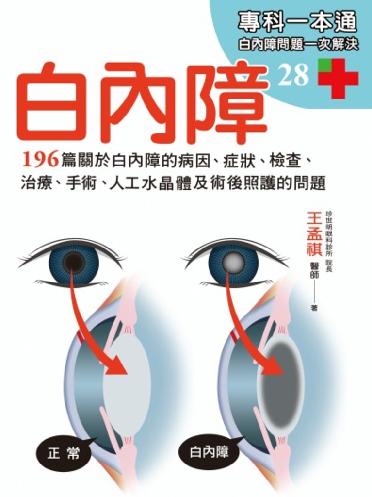 白內障
