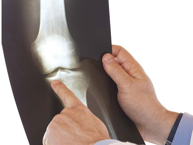 女性關節軟骨越磨越薄老化機率是男性3倍 Pubu 電子書城